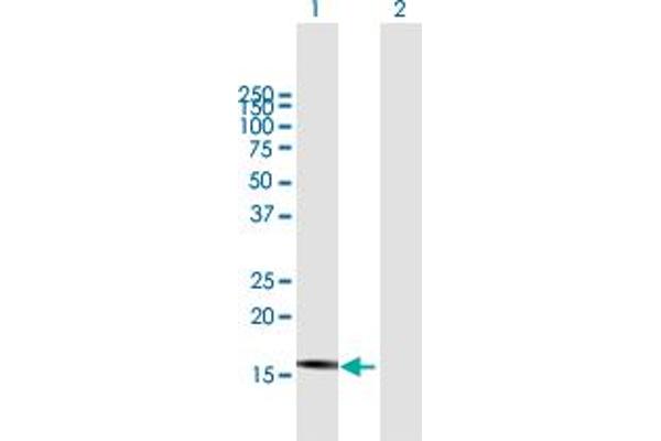 DnaJ (Hsp40) Homolog, Subfamily B, Member 3 (DNAJB3) (AA 1-145) Antikörper