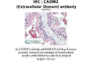 Image no. 1 for anti-Cell Adhesion Molecule 2 (CADM2) (Extracellular Domain) antibody (ABIN1732535) (CADM2 Antikörper  (Extracellular Domain))