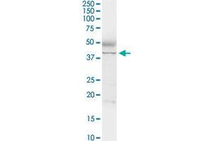 ADA MaxPab rabbit polyclonal antibody. (ADA Antikörper  (AA 1-363))