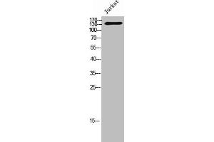 Western Blot analysis of Jurkat cells using STAG3 Polyclonal Antibody (STAG3 Antikörper  (C-Term))