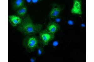 Anti-MAPK7 mouse monoclonal antibody (ABIN2454054) immunofluorescent staining of COS7 cells transiently transfected by pCMV6-ENTRY MAPK7 (RC203506). (MAPK7 Antikörper)