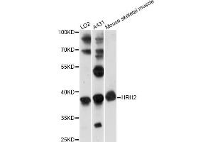 Western blot analysis of extracts of various cell lines, using HRH2 antibody (ABIN6290488) at 1:1000 dilution. (HRH2 Antikörper)