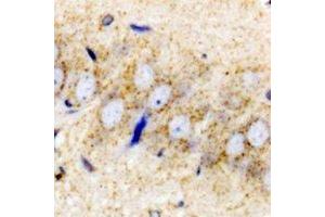 Immunohistochemistry (IHC) image for anti-Proenkephalin (PENK) antibody (ABIN7308156) (Enkephalin Antikörper)