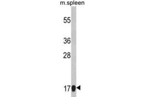 Western Blotting (WB) image for anti-Ribosomal Protein S18 (RPS18) antibody (ABIN3002859) (RPS18 Antikörper)
