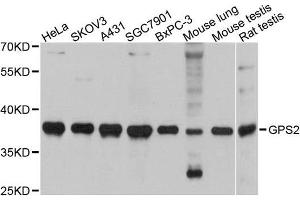 Western blot analysis of extracts of various cell lines, using GPS2 antibody. (GPS2 Antikörper)