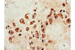 Immunohistochemistry of paraffin-embedded human placenta tissue using ABIN7150615 at dilution of 1:100