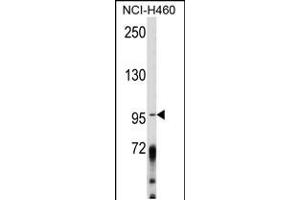 Western blot analysis of AK Antibody (Center) (ABIN652454 and ABIN2842308) in NCI- cell line lysates (35 μg/lane). (AKAP3 Antikörper  (AA 240-267))