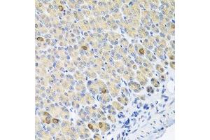 Immunohistochemistry of paraffin-embedded mouse stomach using GLS antibody. (Glutaminase Antikörper  (AA 610-669))
