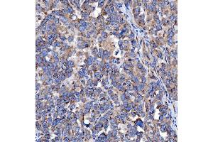 IHC analysis of TTC7B using anti-TTC7B antibody (ABIN7601050). (TTC7B Antikörper  (AA 275-730))