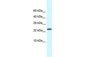 Image no. 1 for anti-Cold Shock Domain Containing C2, RNA Binding (CSDC2) (AA 21-70) antibody (ABIN6747761) (CSDC2 Antikörper  (AA 21-70))