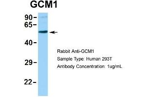 Western Blotting (WB) image for anti-Glial Cells Missing Homolog 1 (GCM1) (N-Term) antibody (ABIN2792608)