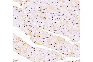 Immunohistochemistry (Paraffin-embedded Sections) (IHC (p)) image for anti-DEAD (Asp-Glu-Ala-As) Box Polypeptide 19B (DDX19B) antibody (ABIN7073694)