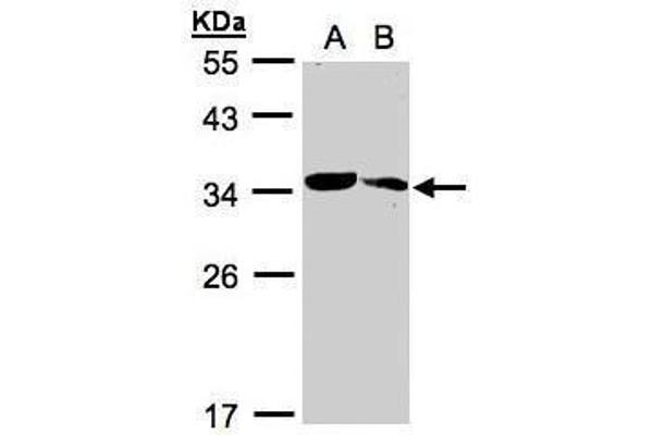 MMACHC antibody  (Center)