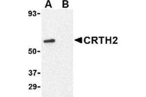 Western blot analysis of CRTH2 in Jurkat cell lysate with CRTH2 antibody at 1 μg/ml in (A) the absence and (B) presence of blocking peptide. (Prostaglandin D2 Receptor 2 (PTGDR2) (N-Term) Antikörper)