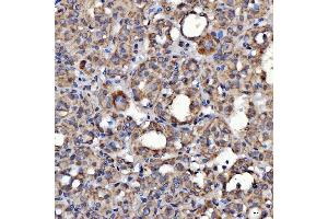 IHC analysis of SARS2 using anti-SARS2 antibody (ABIN7601804).