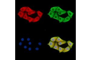 ABIN7095870 and ABIN7099932 staining Hela cells by IF/ICC. (PARP16 Antikörper)