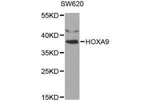 Western blot analysis of extracts of SW620 cells, using HOXA9 antibody (ABIN5970979) at 1/1000 dilution. (HOXA9 Antikörper)