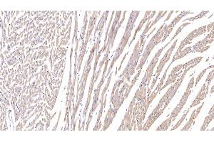 Immunohistochemistry (IHC) image for anti-R-Spondin 1 (RSPO1) (AA 136-262) antibody (ABIN7437200)
