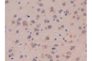 Immunohistochemistry (IHC) image for anti-Interleukin 11 Receptor, alpha (IL11RA) (AA 194-329) antibody (ABIN7438169)