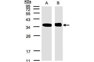 WB Image Sample(30 μg of whole cell lysate) A:293T B:Raji, 12% SDS PAGE antibody diluted at 1:500 (NMI Antikörper)