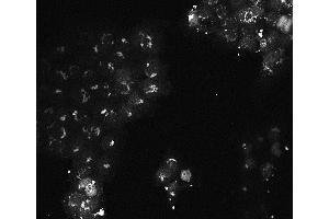 Immunofluorescence of Mouse monoclonal anti-AKT3 antibody Cell Type: A431 cells Fixation: 4% paraformaldehyde 10 min Permeablization: 0. (AKT3 Antikörper  (Internal Region))