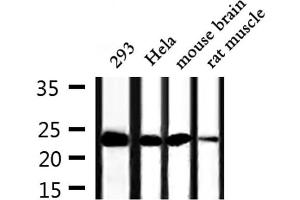 Western blot analysis of extracts from 293,Hela,mouse brain and rat muscle, using TPT1 Antibody.