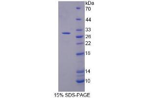 SDS-PAGE analysis of Human Mucin 17 Protein. (MUC17 Protein)