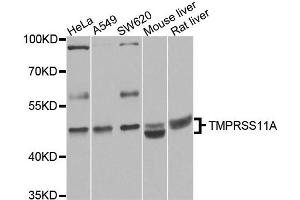 Western blot analysis of extracts of various cell lines, using TMPRSS11A antibody. (TMPRSS11A Antikörper)