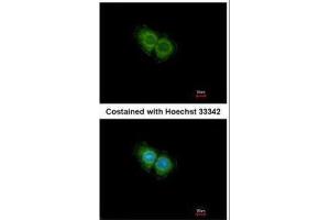ICC/IF Image Immunofluorescence analysis of methanol-fixed Hep G2, using CXCR1, antibody at 1:500 dilution. (CXCR1 Antikörper  (C-Term))
