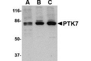 Western Blotting (WB) image for anti-PTK7 Protein tyrosine Kinase 7 (PTK7) (N-Term) antibody (ABIN1031528) (PTK7 Antikörper  (N-Term))
