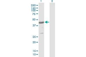 Western Blot analysis of CYTH4 expression in transfected 293T cell line by CYTH4 MaxPab polyclonal antibody. (Cytohesin 4 Antikörper  (AA 1-394))