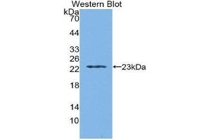 Western Blotting (WB) image for anti-Tryptophanyl-tRNA Synthetase (WARS) (AA 29-195) antibody (ABIN1860958) (WARS Antikörper  (AA 29-195))