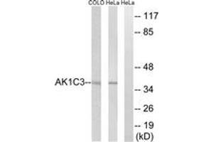 Western blot analysis of extracts from HeLa/COLO cells, using AKR1C3 Antibody. (AKR1C3 Antikörper  (AA 191-240))