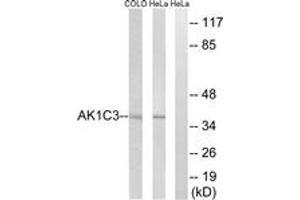 Western Blotting (WB) image for anti-Aldo-Keto Reductase Family 1, Member C3 (3-alpha Hydroxysteroid Dehydrogenase, Type II) (AKR1C3) (AA 191-240) antibody (ABIN1534617)