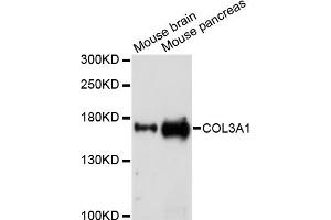 Western blot analysis of extracts of various cell lines, using COL3A1 antibody (ABIN5971985) at 1/1000 dilution. (COL3A1 Antikörper)