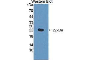 Detection of Recombinant TNFRSF14, Human using Polyclonal Antibody to Tumor Necrosis Factor Receptor Superfamily, Member 14 (TNFRSF14) (HVEM Antikörper  (AA 41-209))