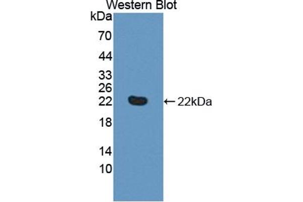 HVEM antibody  (AA 41-209)
