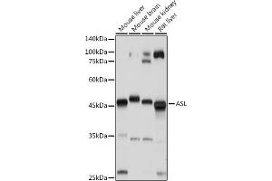 Western blot analysis of extracts of various cell lines, using ASL antibody (ABIN6127448, ABIN6137201, ABIN6137202 and ABIN6221972) at 1:1000 dilution. (ASL Antikörper  (AA 1-300))