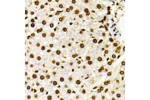 Immunohistochemistry of paraffin-embedded Rat liver using H3K27me2 antibody at dilution of 1:100 (x400 lens). (Histone 3 Antikörper  (H3K27me))