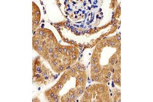 Immunohistochemistry (Paraffin-embedded Sections) (IHC (p)) image for anti-Adenylate Kinase 4 (AK4) (AA 119-153) antibody (ABIN1944856)