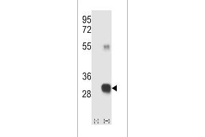 Western blot analysis of RCE1 (arrow) using rabbit polyclonal RCE1 Antibody (W57) (ABIN389050 and ABIN2839259). (RCE1/FACE2 Antikörper  (N-Term))