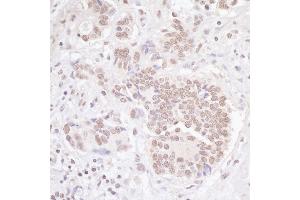 anti-Transducin (Beta)-Like 1 X-Linked Receptor 1 (TBL1XR1) (AA 100-150) antibody