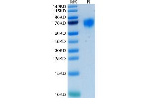 Human FGFR4 on Tris-Bis PAGE under reduced condition. (FGFR4 Protein (AA 22-369) (His-Avi Tag))