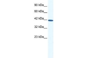 WB Suggested Anti-SOX11 Antibody Titration: 0. (SOX11 Antikörper  (N-Term))
