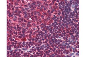 Anti-BLIMP-1 antibody IHC of human colon, lymphoid follicle. (PRDM1 Antikörper  (C-Term))