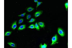 Immunofluorescent analysis of A549 cells using ABIN7165209 at dilution of 1:100 and Alexa Fluor 488-congugated AffiniPure Goat Anti-Rabbit IgG(H+L) (CNIH2 Antikörper  (AA 94-138))