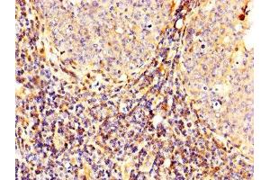 IHC image of ABIN7146540 diluted at 1:300 and staining in paraffin-embedded human tonsil tissue performed on a Leica BondTM system. (Calpain 2 Antikörper  (Catalytic Subunit))