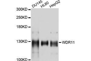 Western blot analysis of extracts of various cell lines, using WDR11 antibody (ABIN4905619) at 1:1000 dilution. (WDR11 Antikörper)