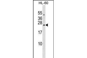 RAB20 Antibody (C-term) (ABIN1536837 and ABIN2849183) western blot analysis in HL-60 cell line lysates (35 μg/lane). (RAB20 Antikörper  (C-Term))