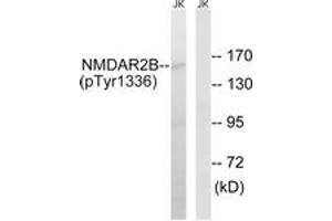 Western blot analysis of extracts from Jurkat cells treated with TNF 20ng/ml 30', using NMDAR2B (Phospho-Tyr1336) Antibody. (GRIN2B Antikörper  (pTyr1336))